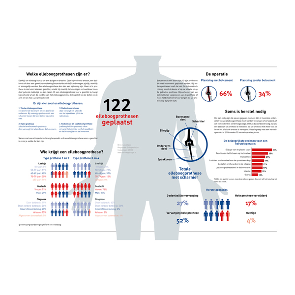 Elleboogprothese ZVB