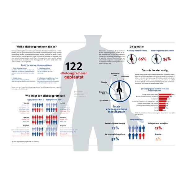 Elleboogprothese ZVB